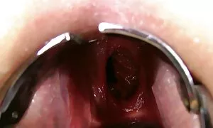 Đối tác đồ của cô gái, dao, vuốt ve. Cô ngồi xổm trước mặt anh và cho anh một thổi kèn, gửi anh ta sâu xuống cổ họng cô với một deep throat. Cô tích cực hút dương vật và nằm trên giường cho mình để làm tình bằng miệng. Các đối tác liếm cô gái, lo lắng sự xấu hổ của những người phụ nữ với lưỡi của mình, và hài lòng con bò cái đã sẵn sàng chấp nhận. Các đối tác đặt trên một trong bao cao su và một tự thâm nhập vào trong âm đạo của các con bò cái. Nó tăng lên trên khuỷu tay để nhận được những cú của xích mích và tận hưởng jav nhật xa lánh giáp xác. Lắc mông của cô, cô cưỡi ngựa, và mệt mỏi vì tình, cô làm việc tích cực với lưỡi của cô.